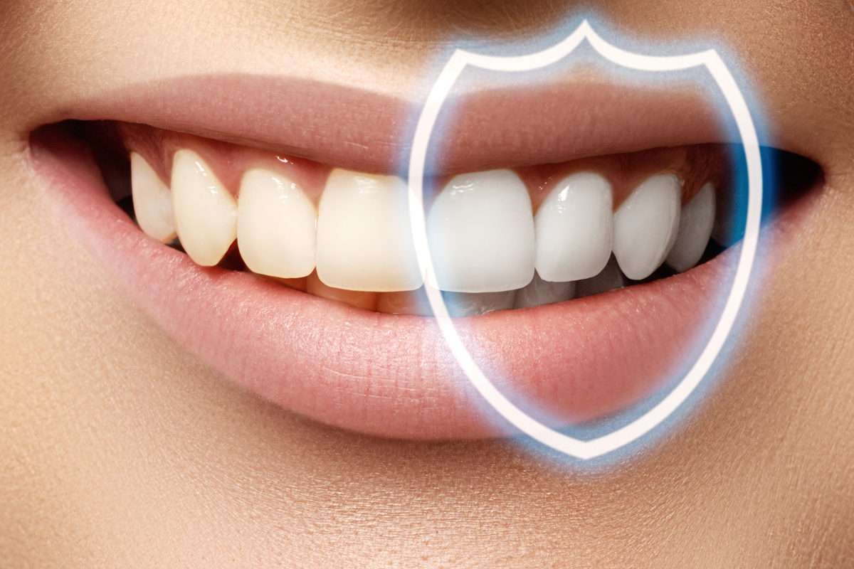 Cosmetic Dentistry