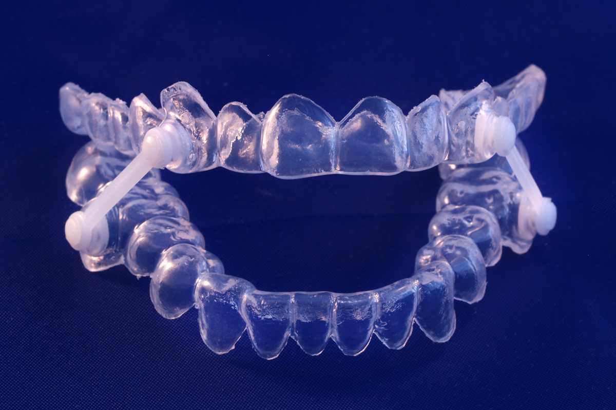 Dental Treatments
